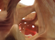 Epidermic Hyperplasia