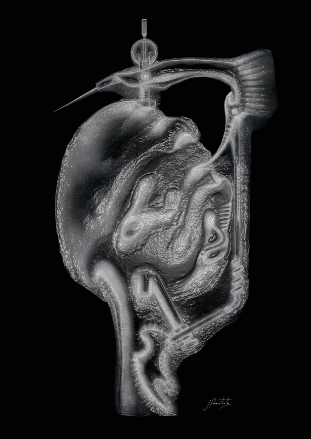 Lobotomy